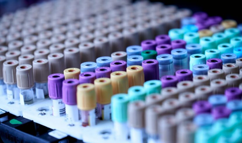 Visiongain Publishes Biobanking Market Report 2024-2034