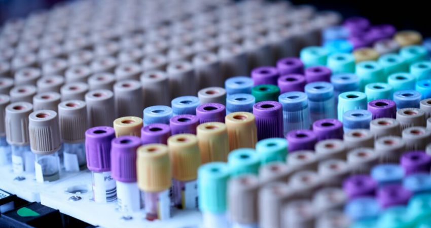 Visiongain Publishes Biobanking Market Report 2024-2034