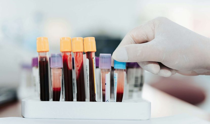 In Vitro Diagnostics Market